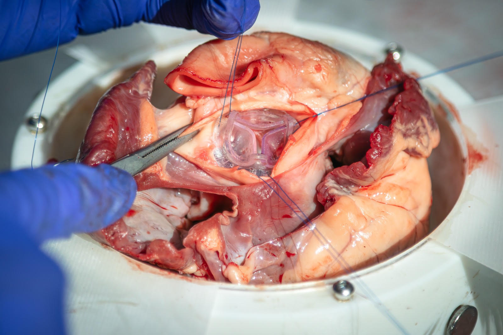 CALIX Cardiac Cup in use during valve training